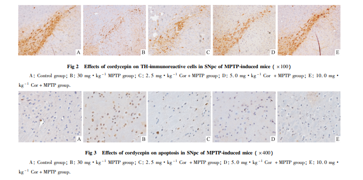 帕金森症论文截图2 帕金森症论文截图2